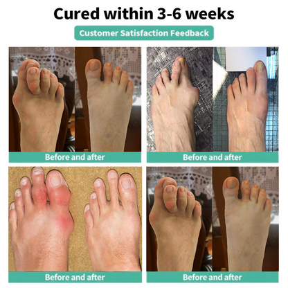 🎁 Only 5 left in stock！Grab one for your other foot too!— Second Pack 50% Off