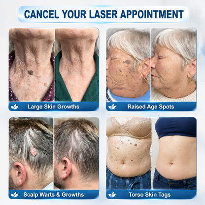 💎💎Natravor® 7-𝐃𝐚𝐲 𝐒𝐤𝐢𝐧 𝐓𝐚𝐠 & 𝐒𝐩𝐨𝐭 𝐄𝐫𝐚𝐬𝐞𝐫 𝐂𝐫𝐞𝐚𝐦 (Zero Pain, Zero 𝐒𝐜𝐚𝐫𝐬 Formula) 💎