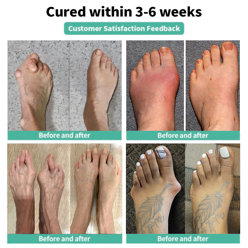 🎁 Only 5 left in stock！Grab one for your other foot too!— Second Pack 50% Off